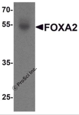 Western blot analysis of FOXA2 in human bladder tissue lysate with FOXA2 antibody at 1 μg/mL.