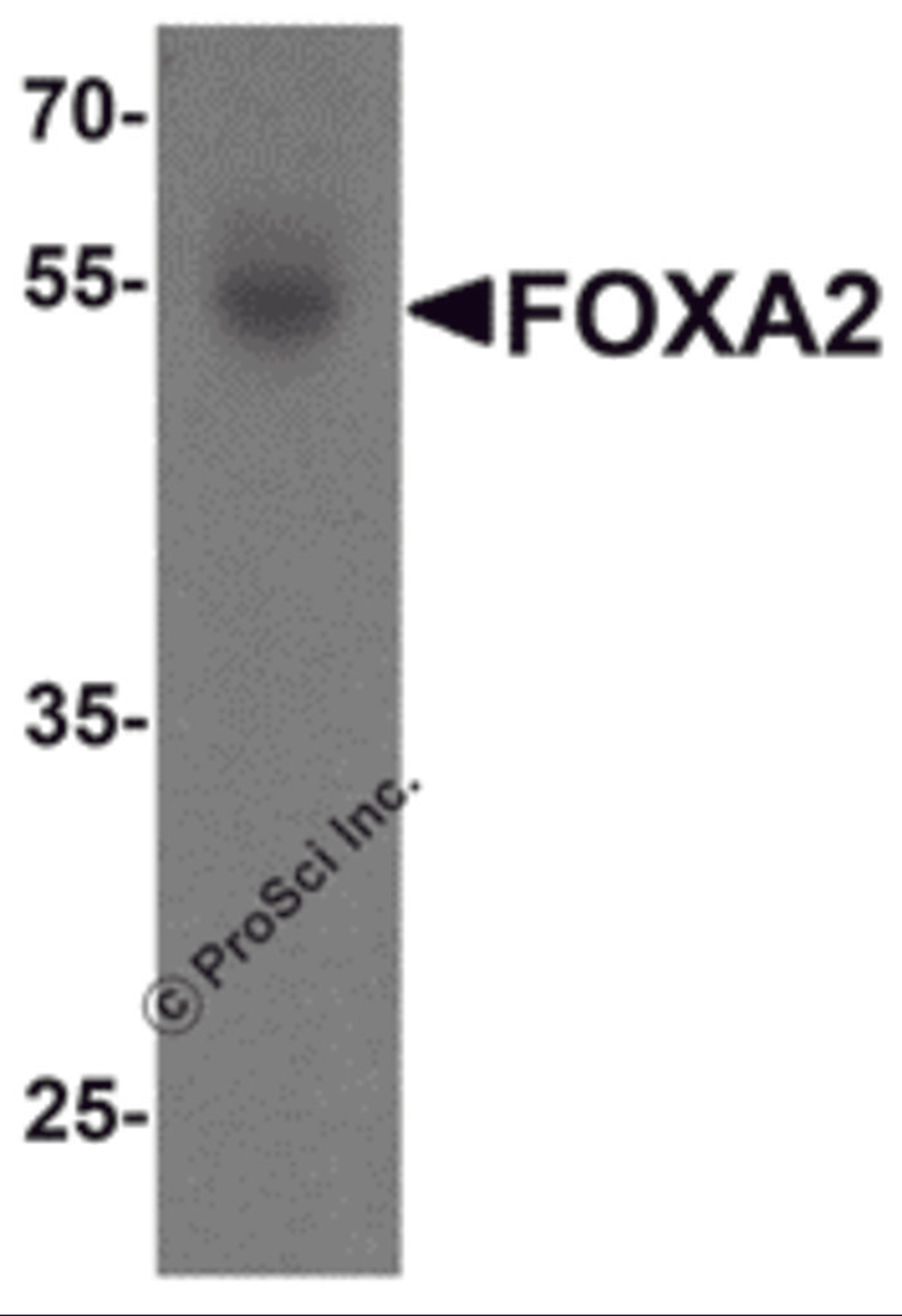Western blot analysis of FOXA2 in human bladder tissue lysate with FOXA2 antibody at 1 μg/mL.