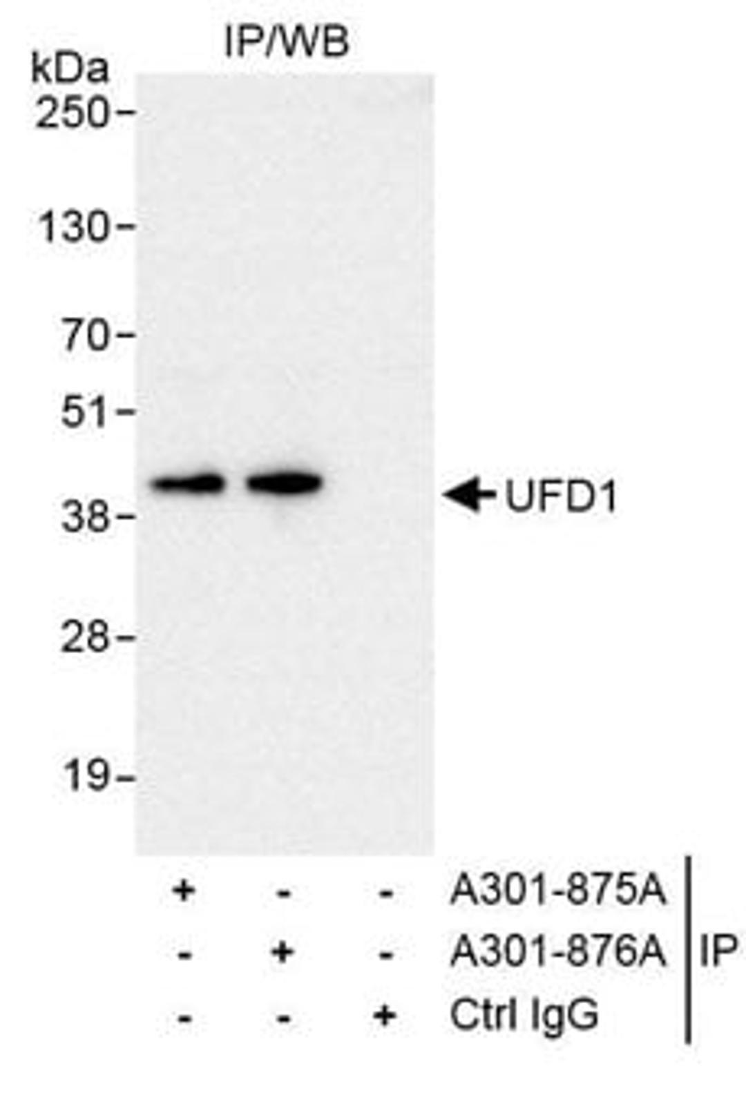 Detection of human UFD1 by western blot of immunoprecipitates.