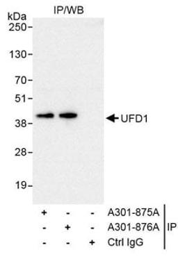 Detection of human UFD1 by western blot of immunoprecipitates.