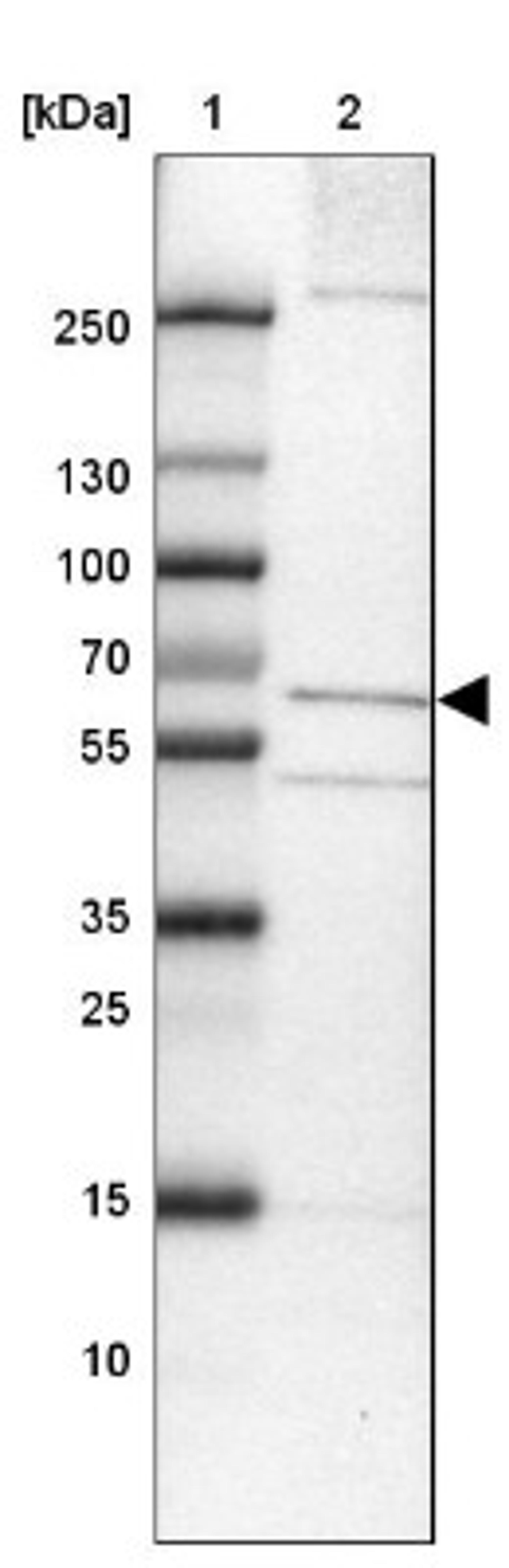 Western Blot: TMEM87A Antibody [NBP1-90532] - Lane 1: Marker [kDa] 250, 130, 100, 70, 55, 35, 25, 15, 10<br/>Lane 2: Liver