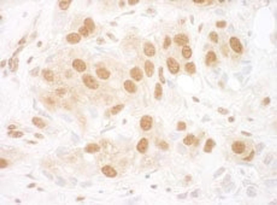 Detection of human RuvBL2 by immunohistochemistry.