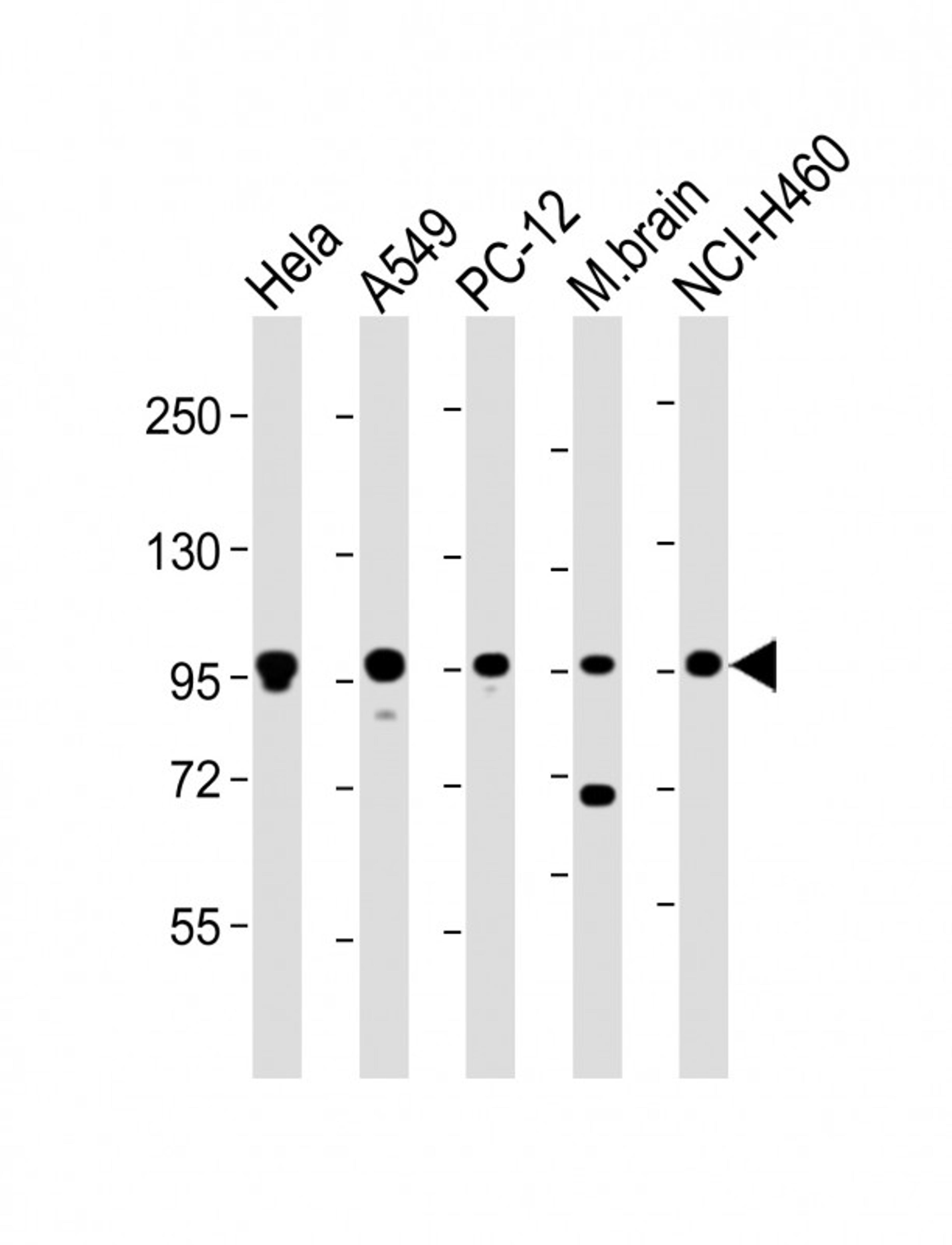 Western Blot at 1:2000 dilution Lane 1: Hela whole cell lysate Lane 2: A549 whole cell lysate Lane 3: PC-12 whole cell lysate Lane 4: mouse brain lysate Lane 5: NCI-H460 whole cell lysate Lysates/proteins at 20 ug per lane.