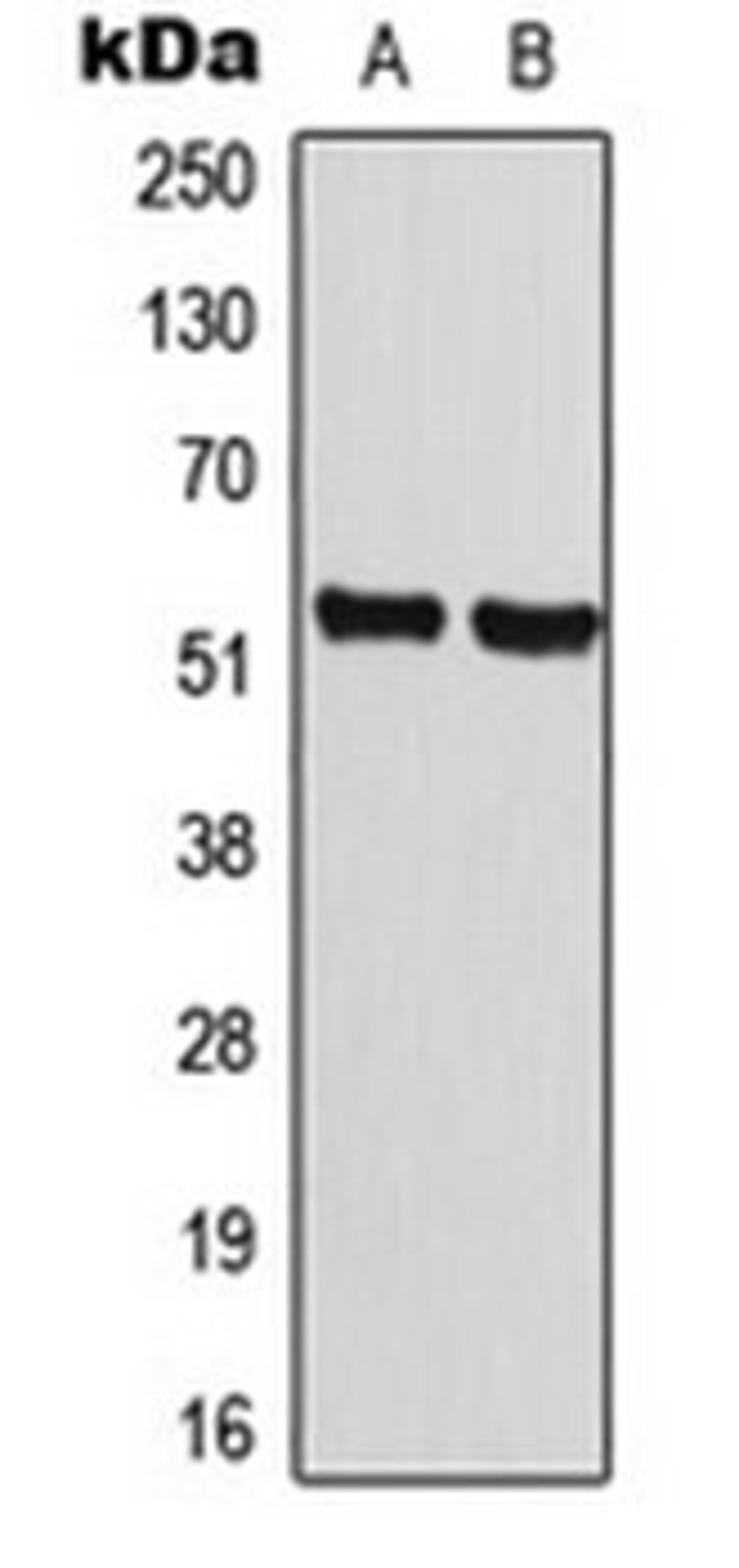 Western blot analysis of MCF7 (Lane 1), NIH3T3 (Lane 2) whole cell lysates using Cyclin A1 antibody