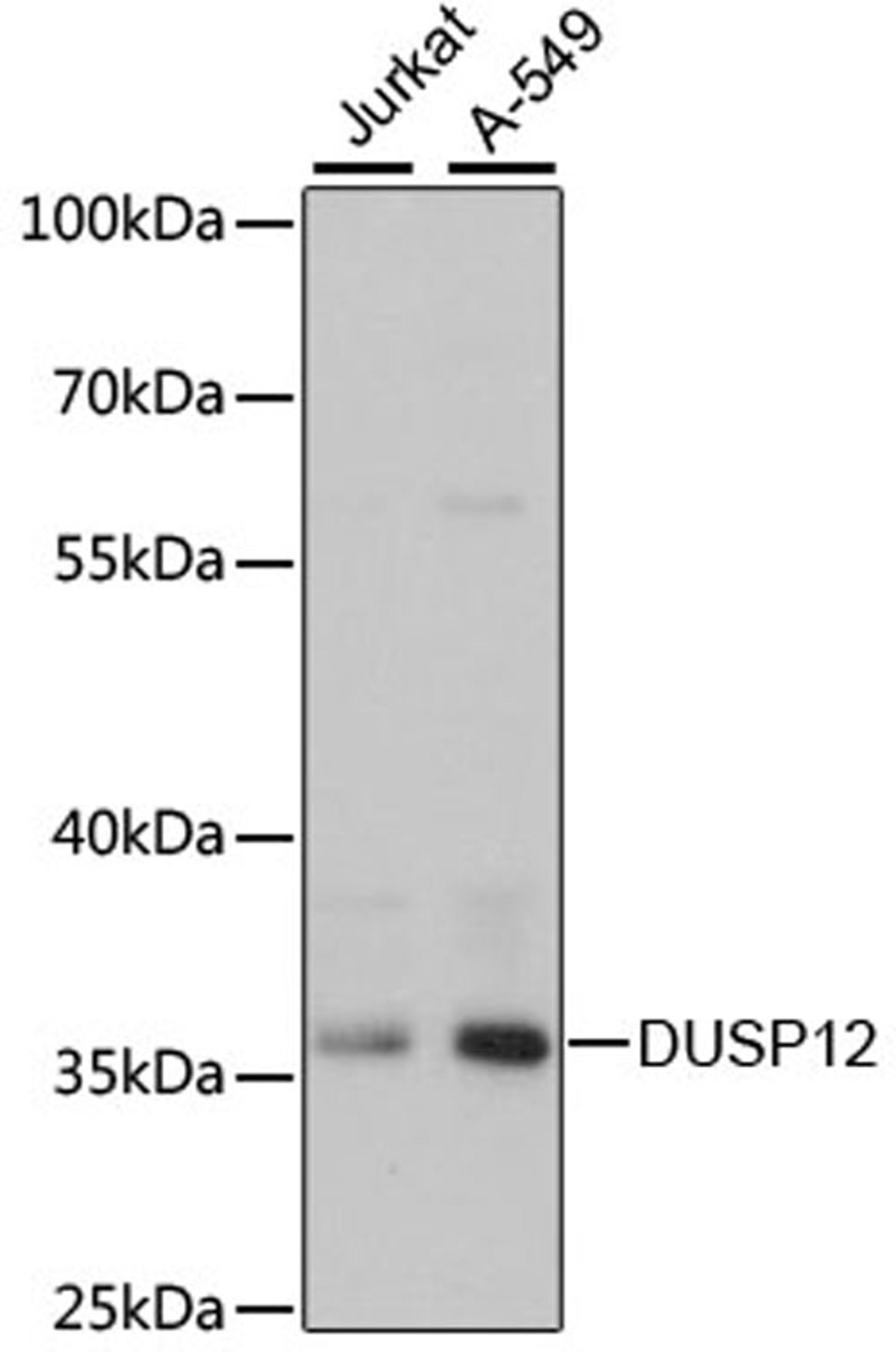 Western blot - DUSP12 antibody (A13247)