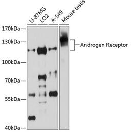 Western blot - Androgen Receptor Antibody (A0330)