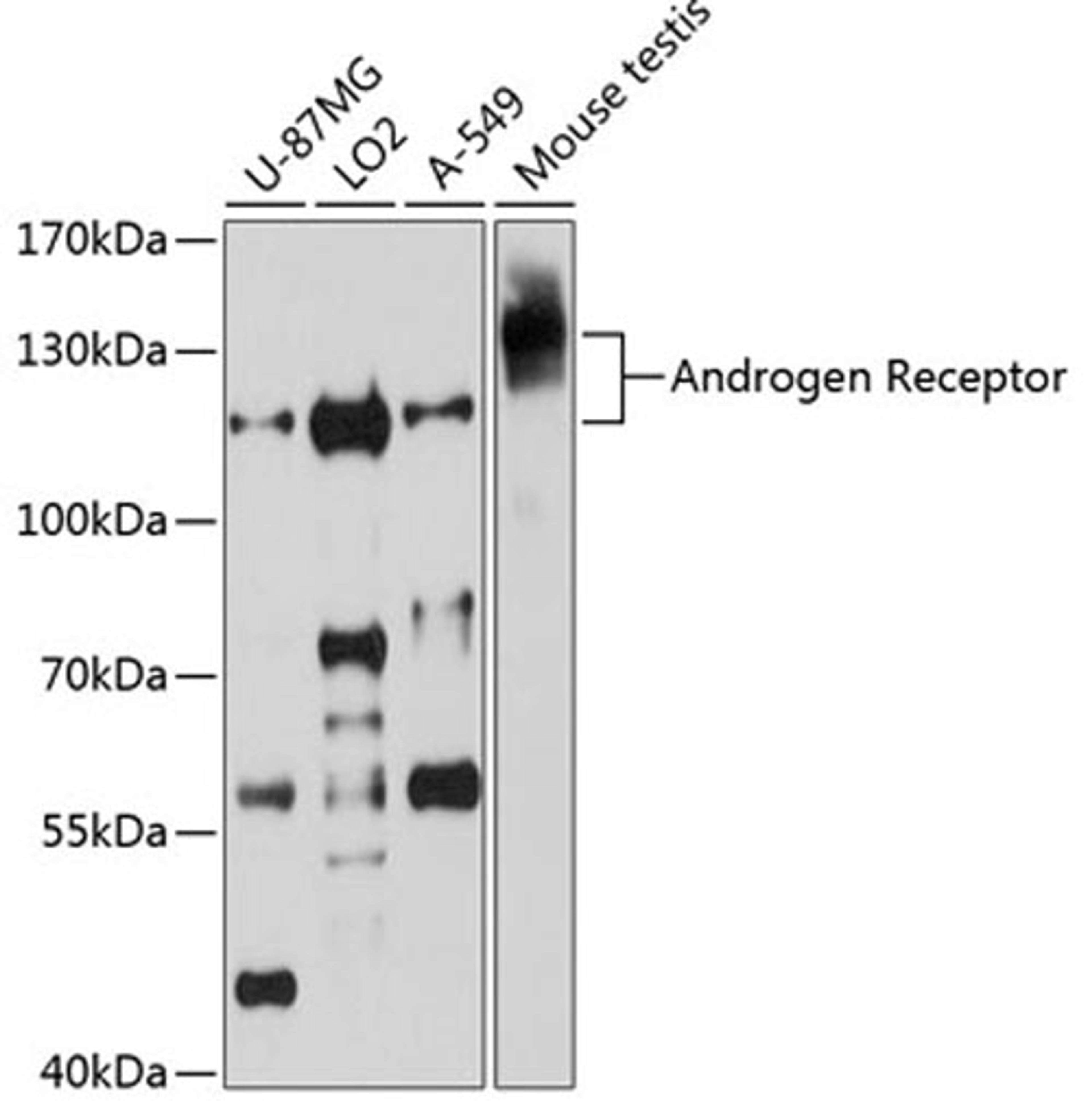 Western blot - Androgen Receptor Antibody (A0330)