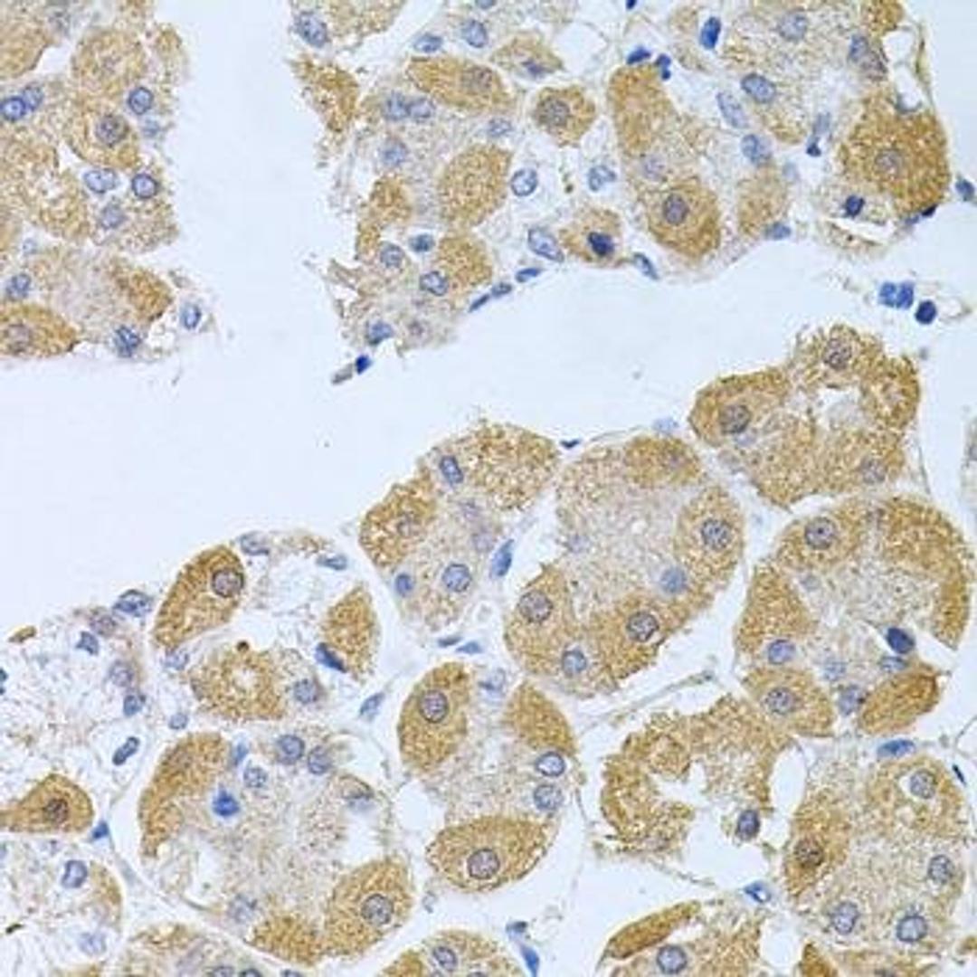 Immunohistochemical staining of mouse spleen tissue using PROK2 antibody (dilution of 1:100)