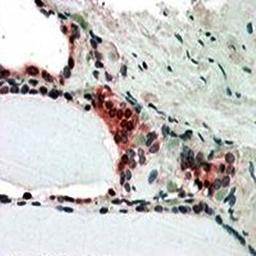 Immunohistochemical analysis of formalin-fixed and paraffin embedded Human Thyroid Gland shows nclear and cytoplasm (3-5ug/ml) using CSN2 antibody