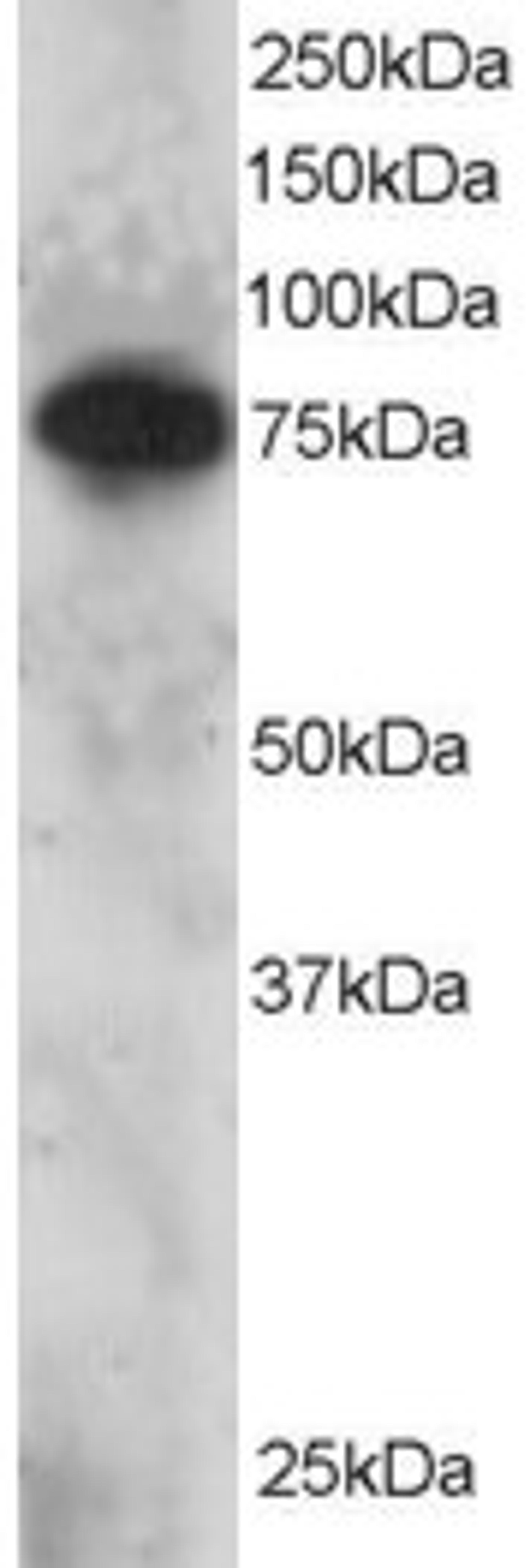 46-362 staining (2ug/ml) of Daudi lysate (RIPA buffer, 30ug total protein per lane). Primary incubated for 12 hour. Detected by chemiluminescence.