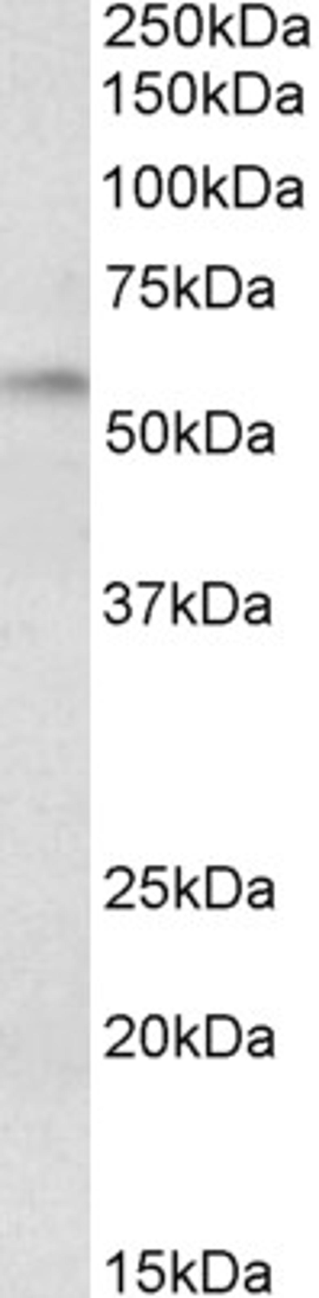 45-475 (0.3ug/ml) staining of Rat Duodenum lysate (35ug protein in RIPA buffer). Primary incubation was 1 hour. Detected by chemiluminescence.