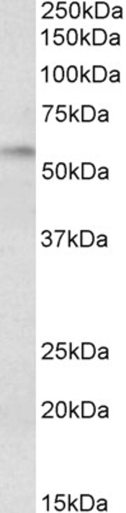 45-475 (0.3ug/ml) staining of Rat Duodenum lysate (35ug protein in RIPA buffer). Primary incubation was 1 hour. Detected by chemiluminescence.