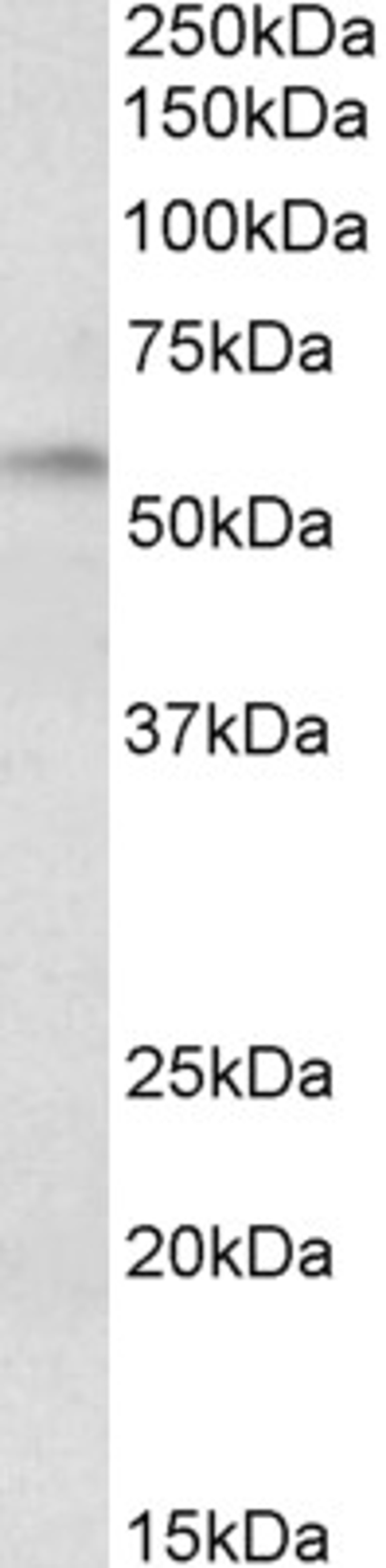 45-475 (0.3ug/ml) staining of Rat Duodenum lysate (35ug protein in RIPA buffer). Primary incubation was 1 hour. Detected by chemiluminescence.