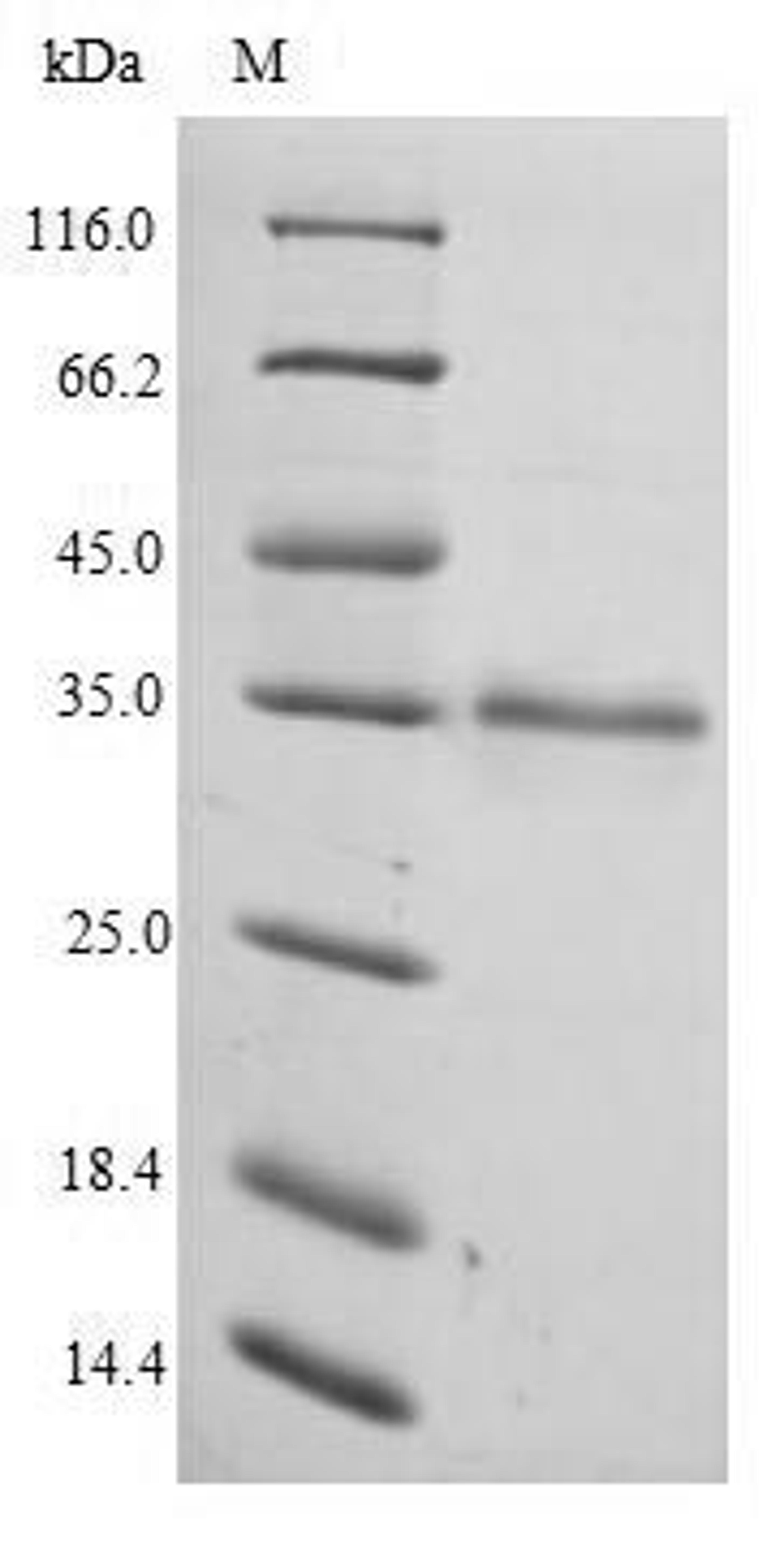 (Tris-Glycine gel) Discontinuous SDS-PAGE (reduced) with 5% enrichment gel and 15% separation gel.