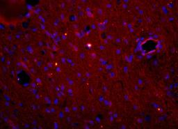  Immunohistochemical staining of mouse brain tissue using Myeloperoxidase antibody