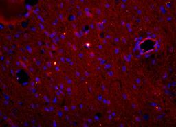 Immunohistochemical staining of mouse brain tissue using Myeloperoxidase antibody