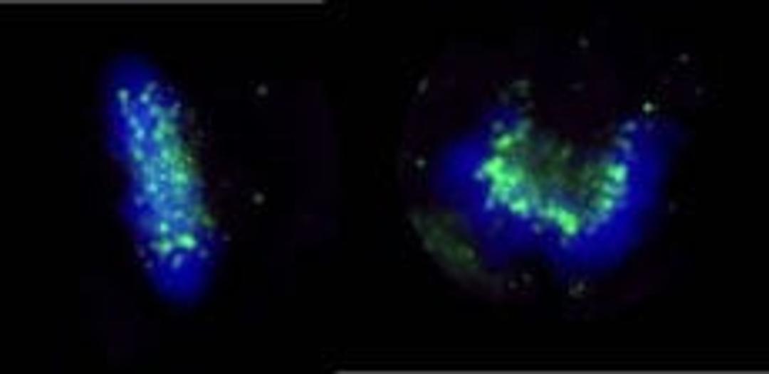 Detection of human ZWINT-1 by immunocytochemistry.