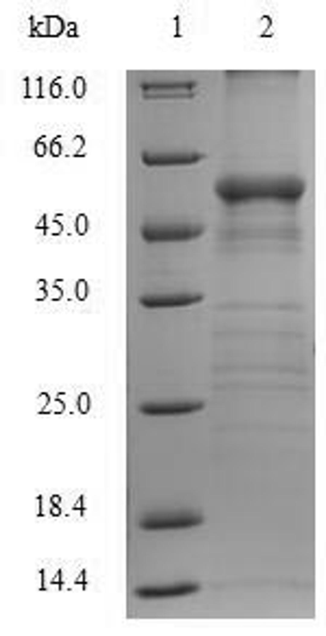 (Tris-Glycine gel) Discontinuous SDS-PAGE (reduced) with 5% enrichment gel and 15% separation gel.