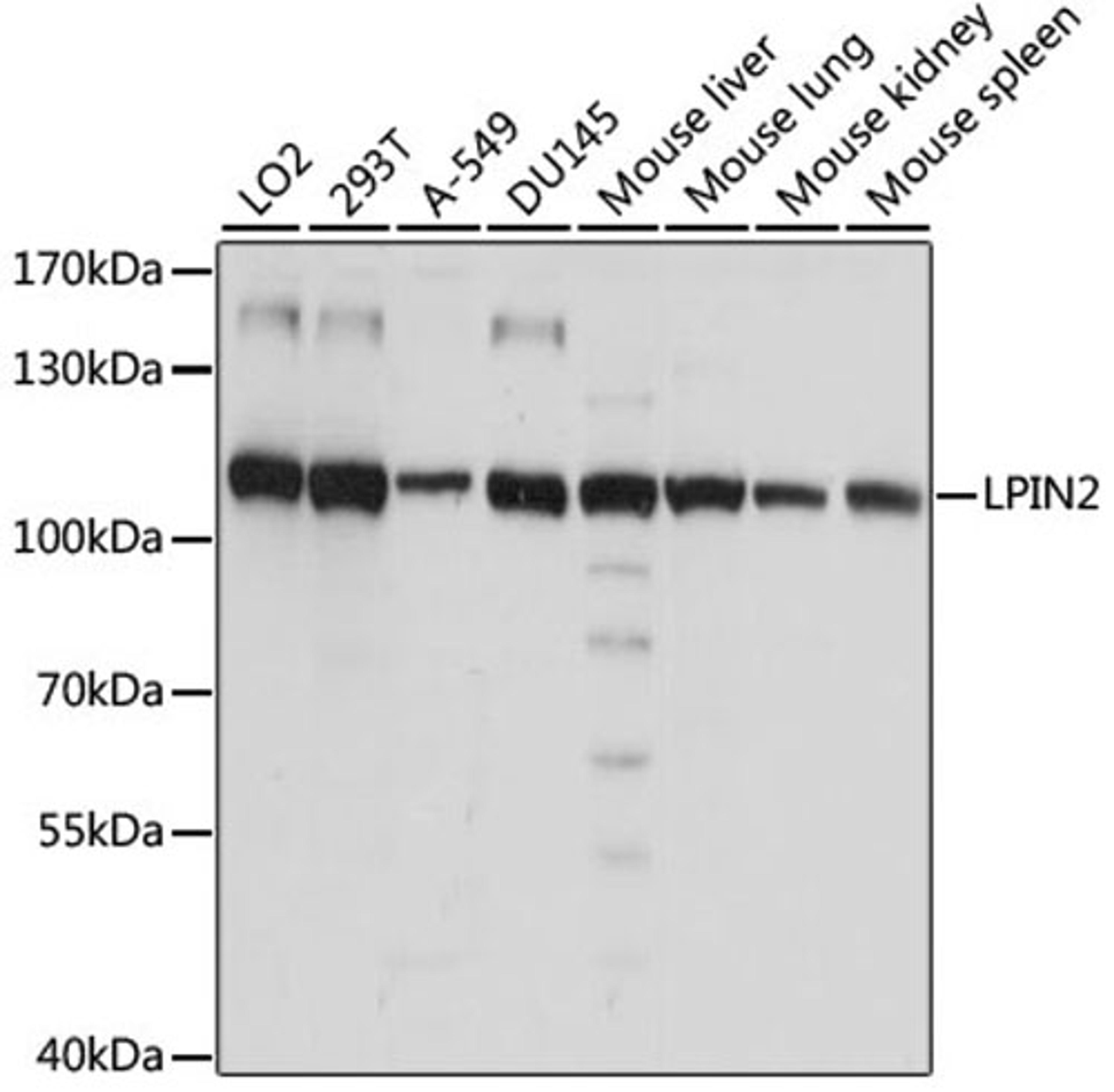 Western blot - LPIN2 antibody (A15762)