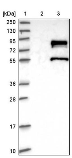 Western Blot: ZNF23 Antibody [NBP1-82867] - Lane 1: Marker [kDa] 250, 130, 95, 72, 55, 36, 28, 17, 10<br/>Lane 2: Negative control (vector only transfected HEK293T lysate)<br/>Lane 3: Over-expression lysate (Co-expressed with a C-terminal myc-DDK tag (~3.1 kDa) in mammalian HEK293T cells, LY407845)