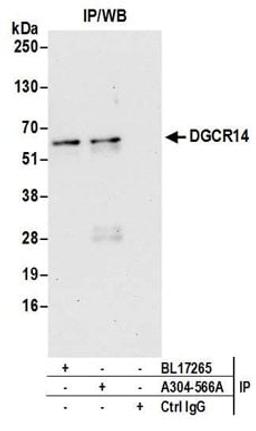 Detection of human DGCR14 by western blot of immunoprecipitates.