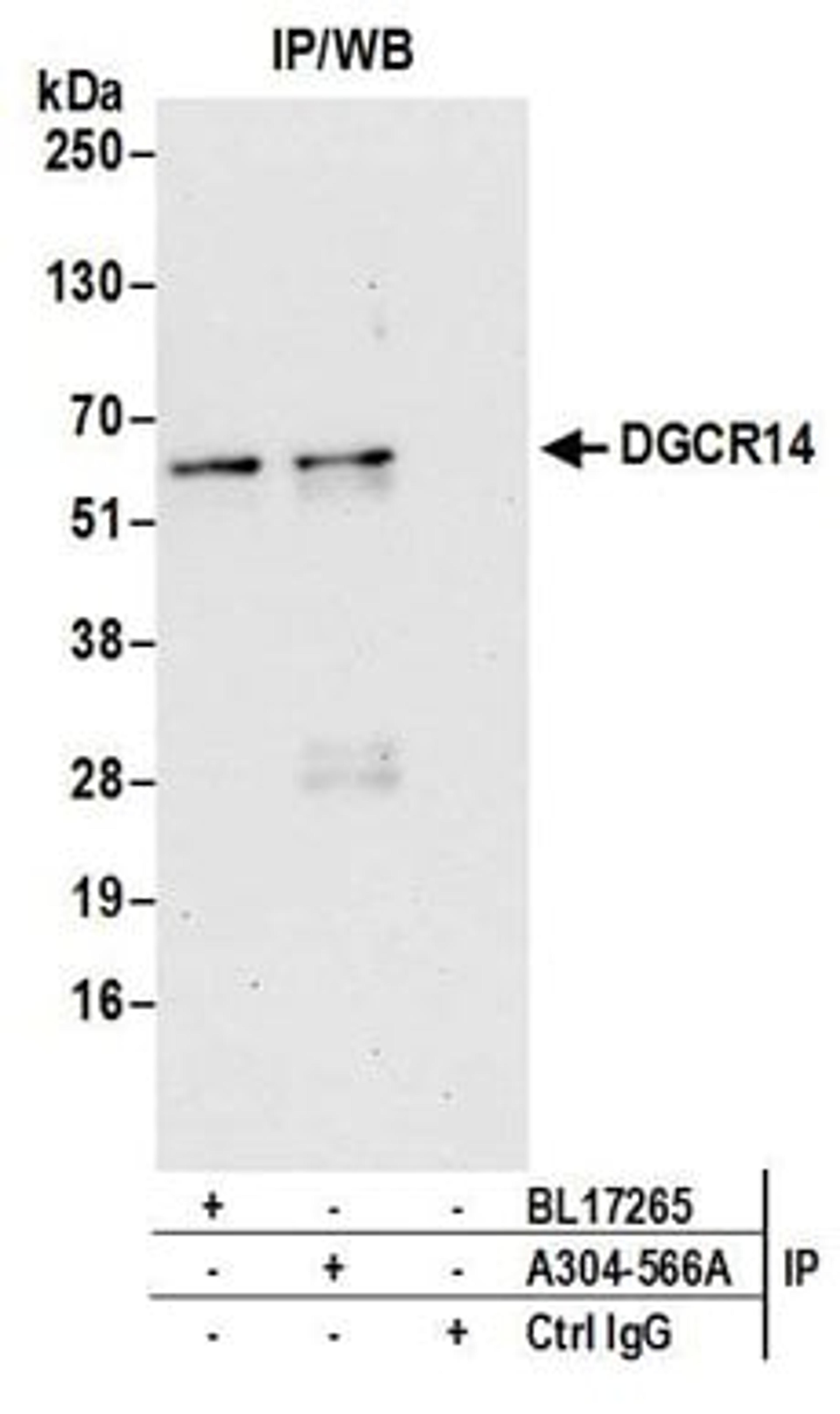 Detection of human DGCR14 by western blot of immunoprecipitates.