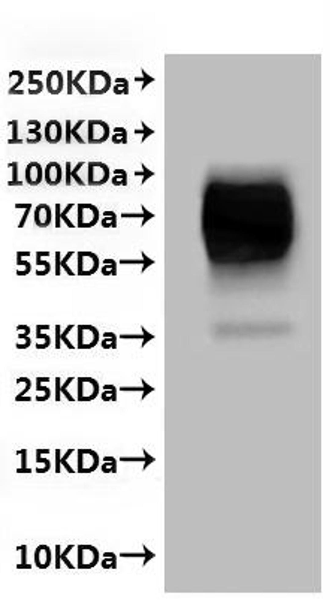 CSB-MP623947HU(A4) is detected by Mouse anti-6*His monoclonal antibody.