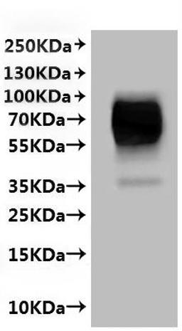 CSB-MP623947HU(A4) is detected by Mouse anti-6*His monoclonal antibody.