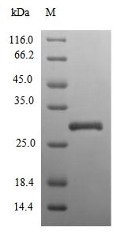 (Tris-Glycine gel) Discontinuous SDS-PAGE (reduced) with 5% enrichment gel and 15% separation gel.