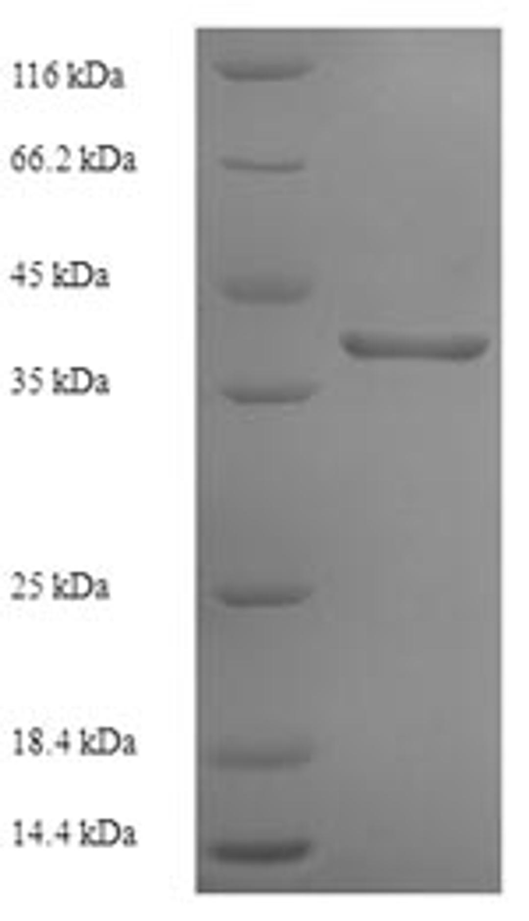 (Tris-Glycine gel) Discontinuous SDS-PAGE (reduced) with 5% enrichment gel and 15% separation gel.