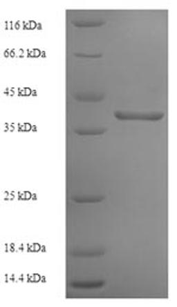 (Tris-Glycine gel) Discontinuous SDS-PAGE (reduced) with 5% enrichment gel and 15% separation gel.