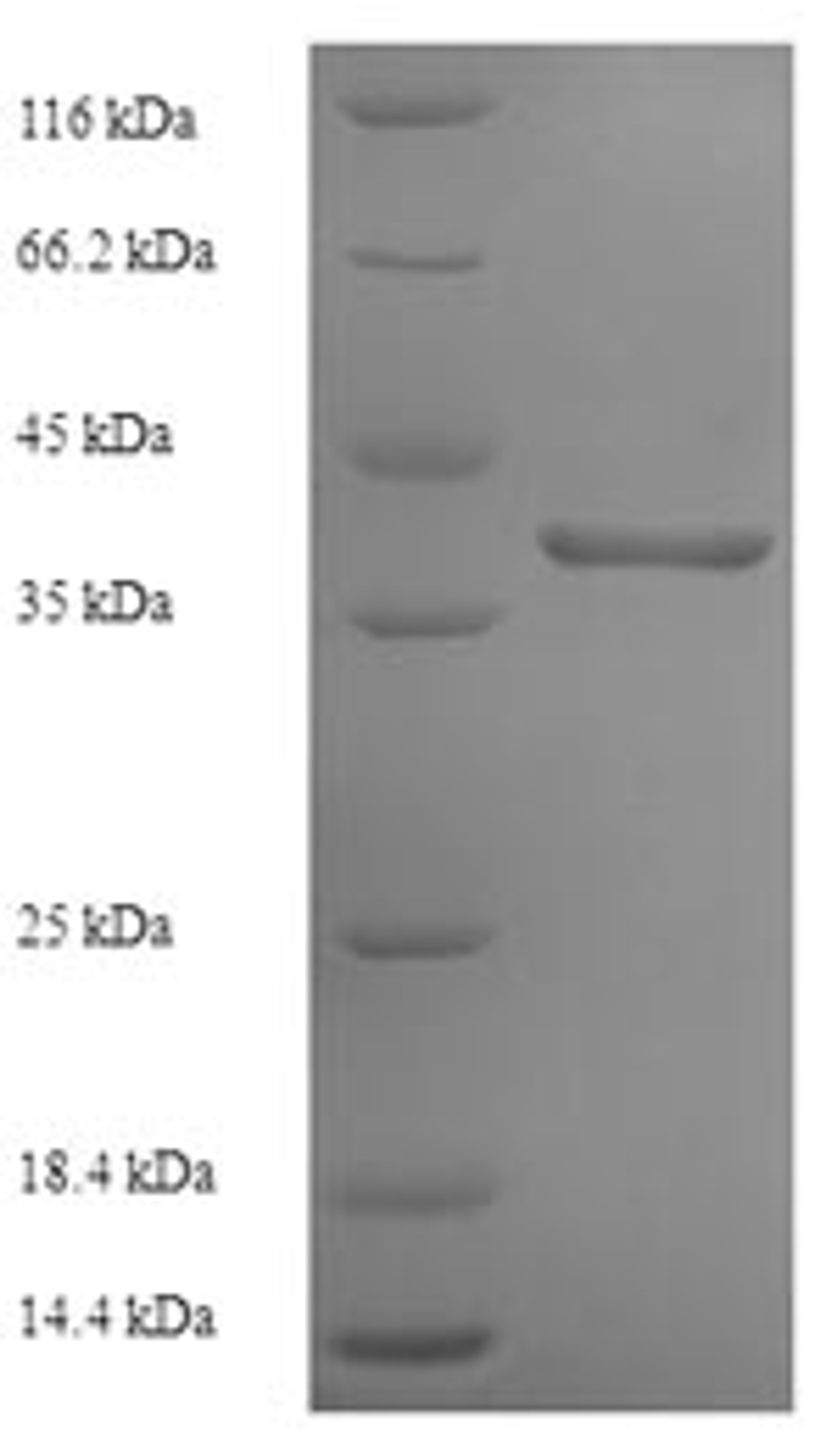 (Tris-Glycine gel) Discontinuous SDS-PAGE (reduced) with 5% enrichment gel and 15% separation gel.