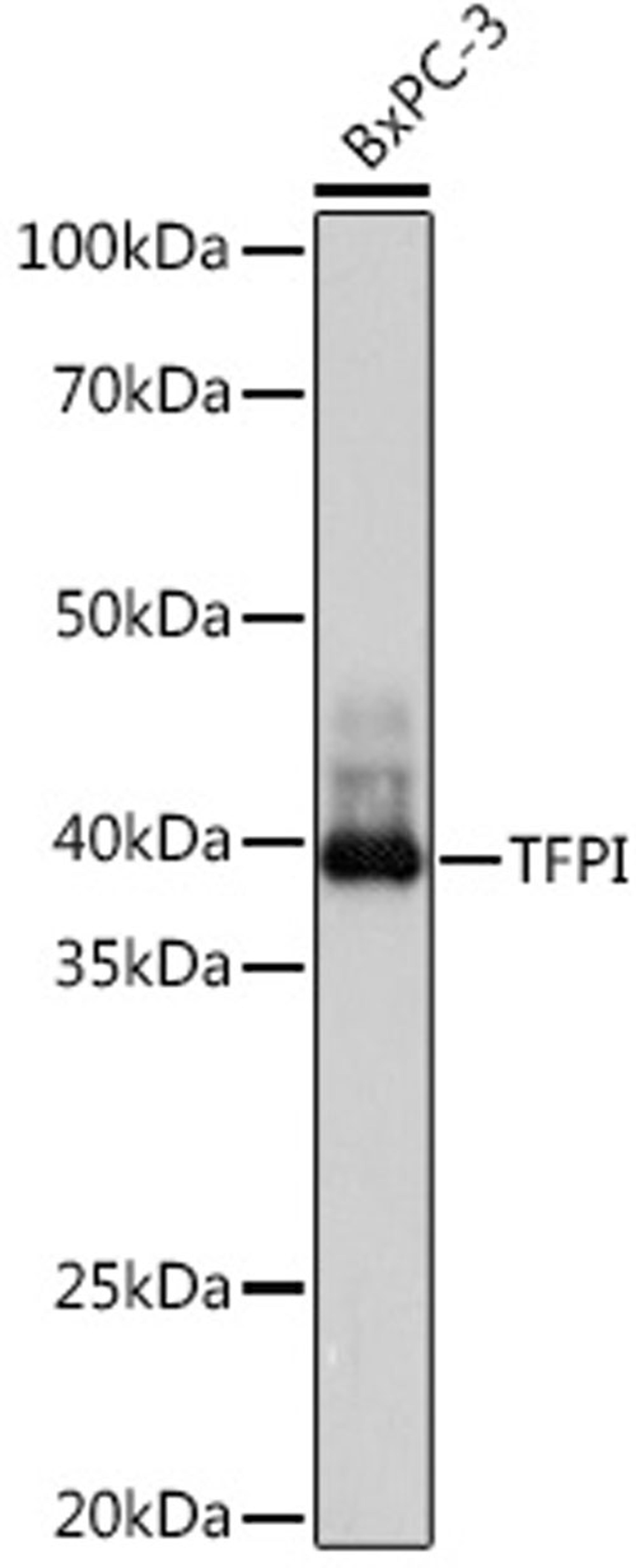 Western blot - TFPI Rabbit mAb (A8704)