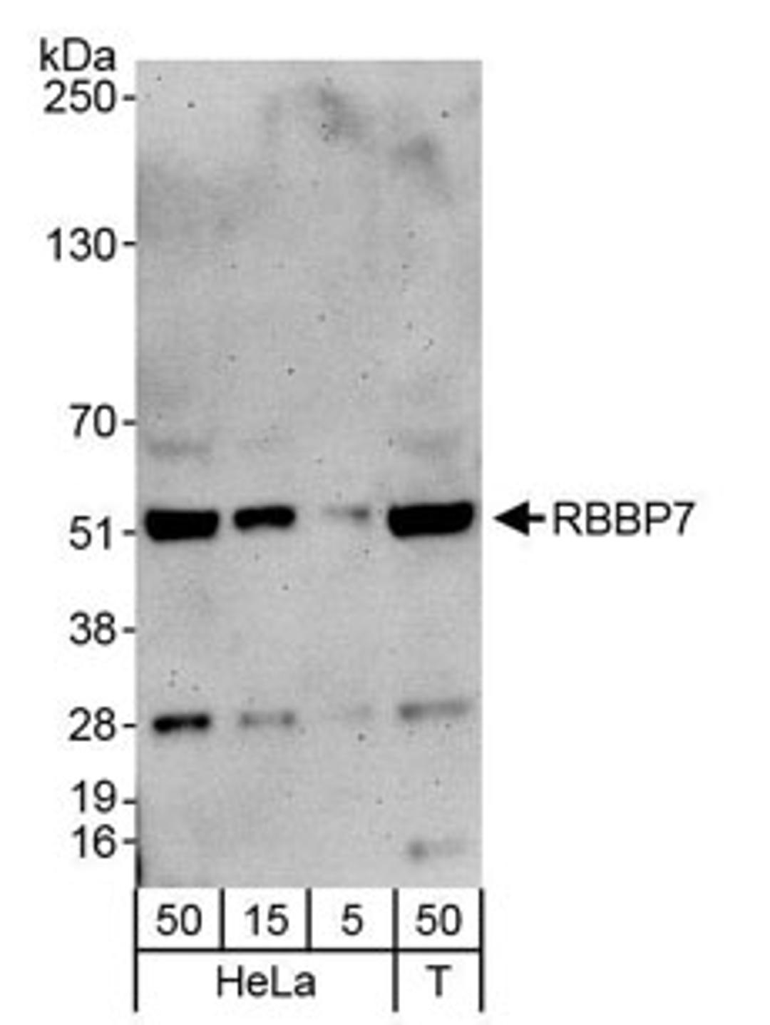 Detection of human RbBP7 by western blot.