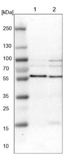 Western Blot: SNX4 Antibody [NBP1-88882] - Lane 1: NIH-3T3 cell lysate (Mouse embryonic fibroblast cells)<br/>Lane 2: NBT-II cell lysate (Rat Wistar bladder tumour cells)