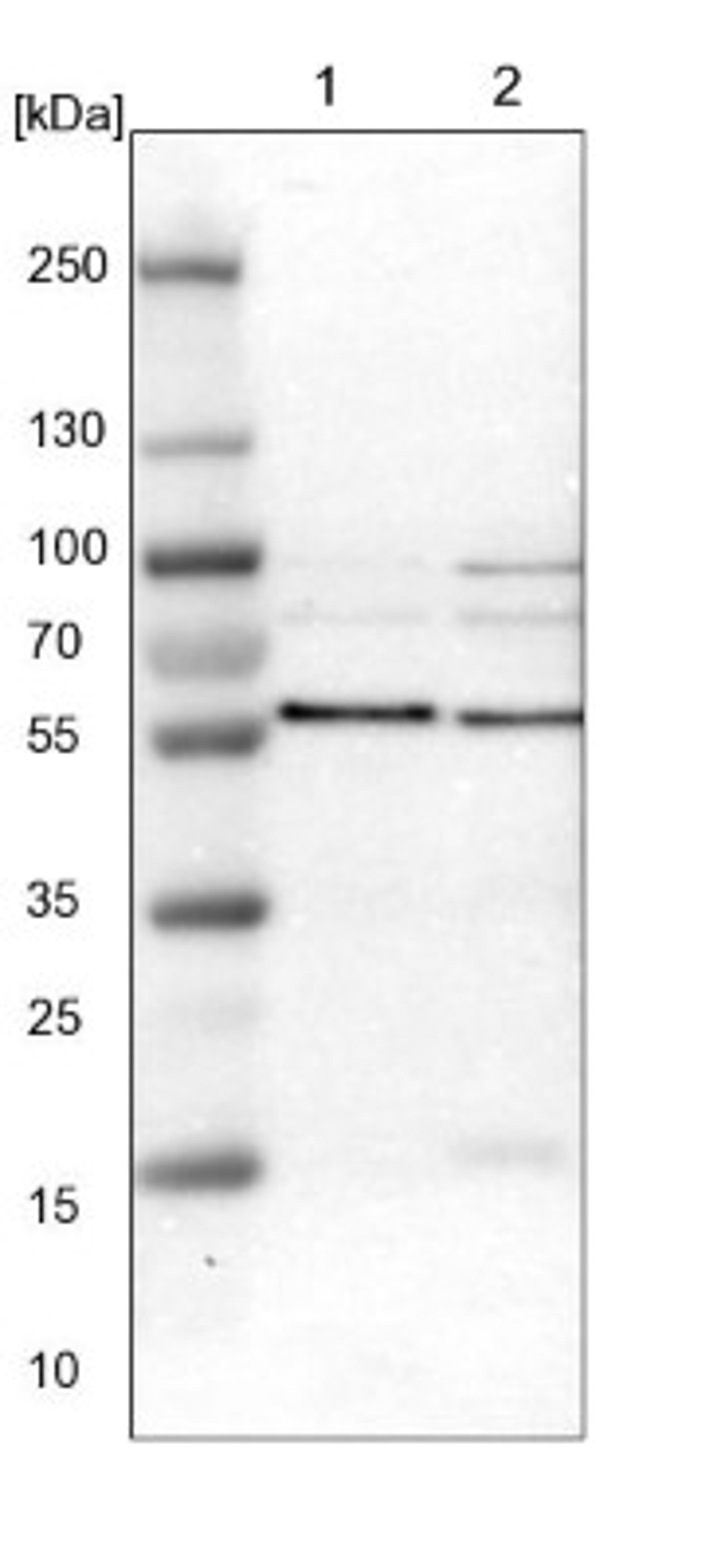 Western Blot: SNX4 Antibody [NBP1-88882] - Lane 1: NIH-3T3 cell lysate (Mouse embryonic fibroblast cells)<br/>Lane 2: NBT-II cell lysate (Rat Wistar bladder tumour cells)