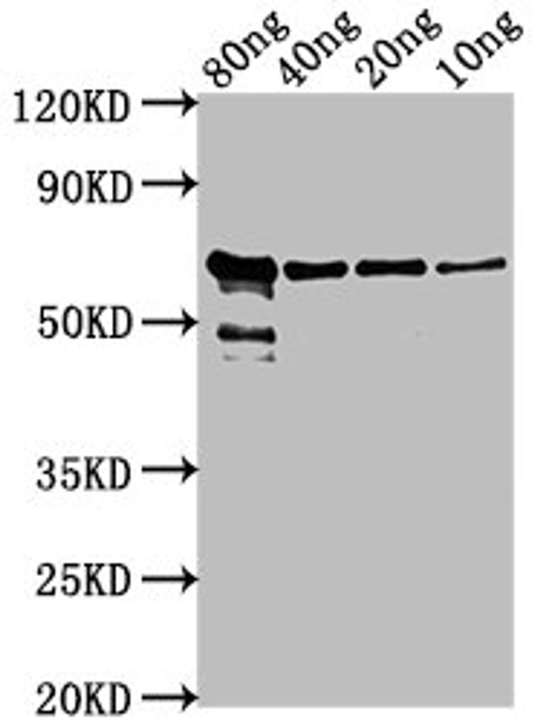 Western Blot. Positive WB detected in Recombinant protein. All lanes: VP2 antibody at 1:2000. Secondary. Goat polyclonal to rabbit IgG at 1/50000 dilution. Predicted band size: 62 kDa. Observed band size: 62 kDa. 
