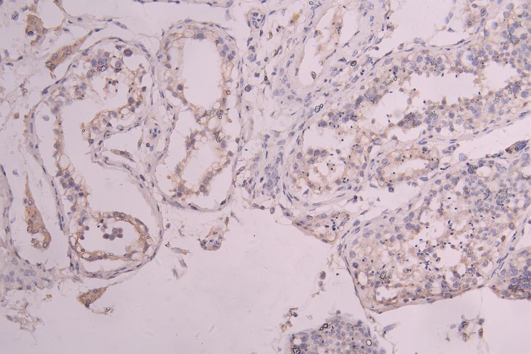 IHC image of CSB-RA012375MA1HU diluted at 1：100 and staining in paraffin-embedded human testis tissue performed on a Leica BondTM system. After dewaxing and hydration, antigen retrieval was mediated by high pressure in a citrate buffer (pH 6.0). Section was blocked with 10% normal goat serum 30min at RT. Then primary antibody (1% BSA) was incubated at 4°C overnight. The primary is detected by a Goat anti-human polymer IgG labeled by HRP and visualized using 0.05% DAB.