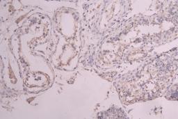 IHC image of CSB-RA012375MA1HU diluted at 1：100 and staining in paraffin-embedded human testis tissue performed on a Leica BondTM system. After dewaxing and hydration, antigen retrieval was mediated by high pressure in a citrate buffer (pH 6.0). Section was blocked with 10% normal goat serum 30min at RT. Then primary antibody (1% BSA) was incubated at 4°C overnight. The primary is detected by a Goat anti-human polymer IgG labeled by HRP and visualized using 0.05% DAB.