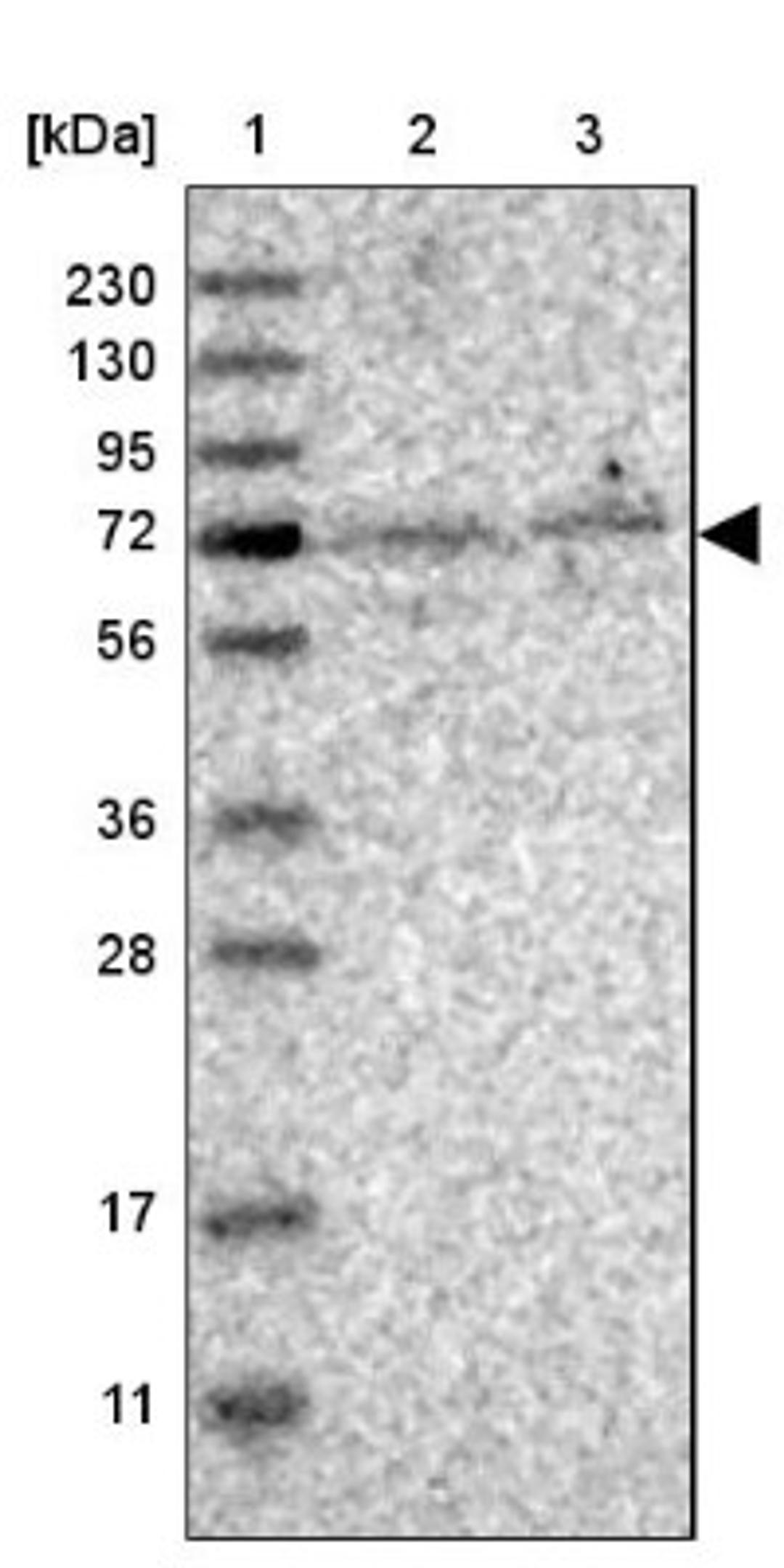 Western Blot: KLHL20 Antibody [NBP1-81559] - Lane 1: Marker [kDa] 230, 130, 95, 72, 56, 36, 28, 17, 11<br/>Lane 2: Human cell line RT-4<br/>Lane 3: Human cell line U-251MG sp