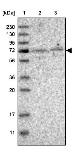 Western Blot: KLHL20 Antibody [NBP1-81559] - Lane 1: Marker [kDa] 230, 130, 95, 72, 56, 36, 28, 17, 11<br/>Lane 2: Human cell line RT-4<br/>Lane 3: Human cell line U-251MG sp