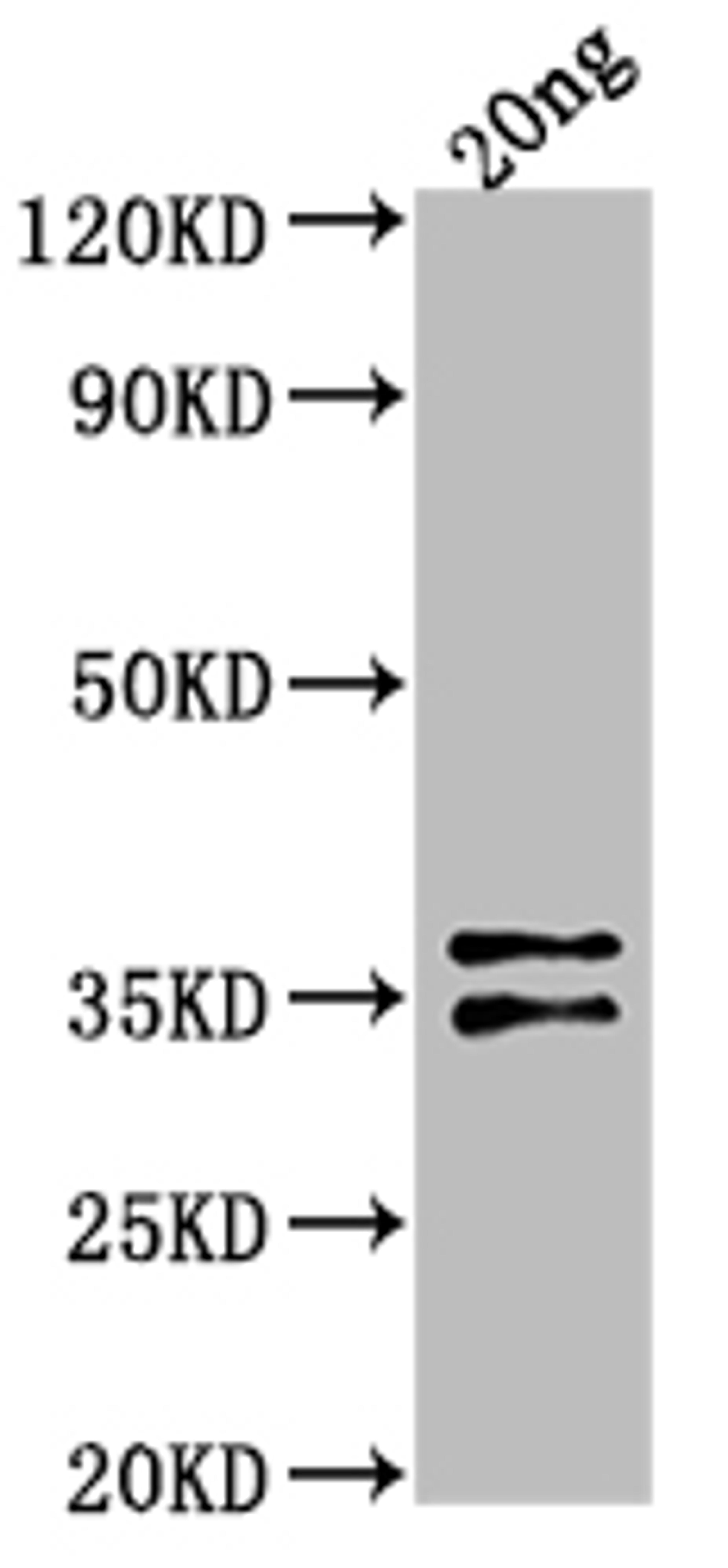 Western Blot. Positive WB detected in Recombinant protein. All lanes: ARCA antibody at 1:2000. Secondary. Goat polyclonal to rabbit IgG at 1/50000 dilution. Predicted band size: 31.4 kDa. Observed band size: 33 kDa. 