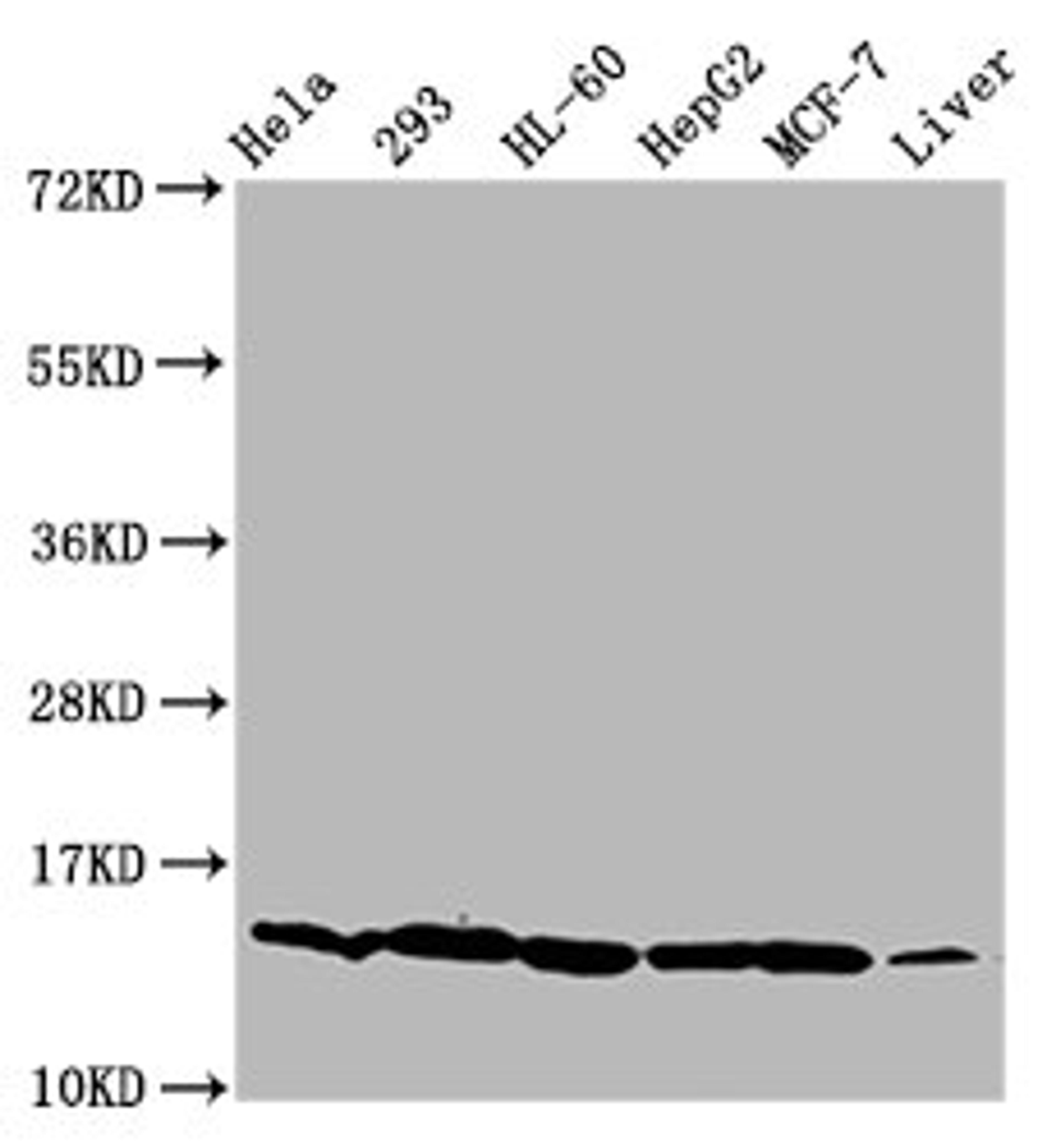 Western Blot. Positive WB detected in: Hela whole cell lysate, 293 whole cell lysate, HL60 whole cell lysate, HepG2 whole cell lysate, MCF-7 whole cell lysate, Mouse liver tissue. All lanes: HIST1H2BC antibody at 0.92µg/ml. Secondary. Goat polyclonal to rabbit IgG at 1/50000 dilution. Predicted band size: 14 kDa. Observed band size: 14 kDa