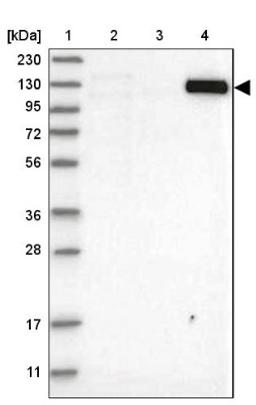 Western Blot: Mkl1 Antibody [NBP1-88498] - Lane 1: Marker [kDa] 230, 130, 95, 72, 56, 36, 28, 17, 11<br/>Lane 2: Human cell line RT-4<br/>Lane 3: Human cell line U-251MG sp<br/>Lane 4: Human plasma (IgG/HSA depleted)