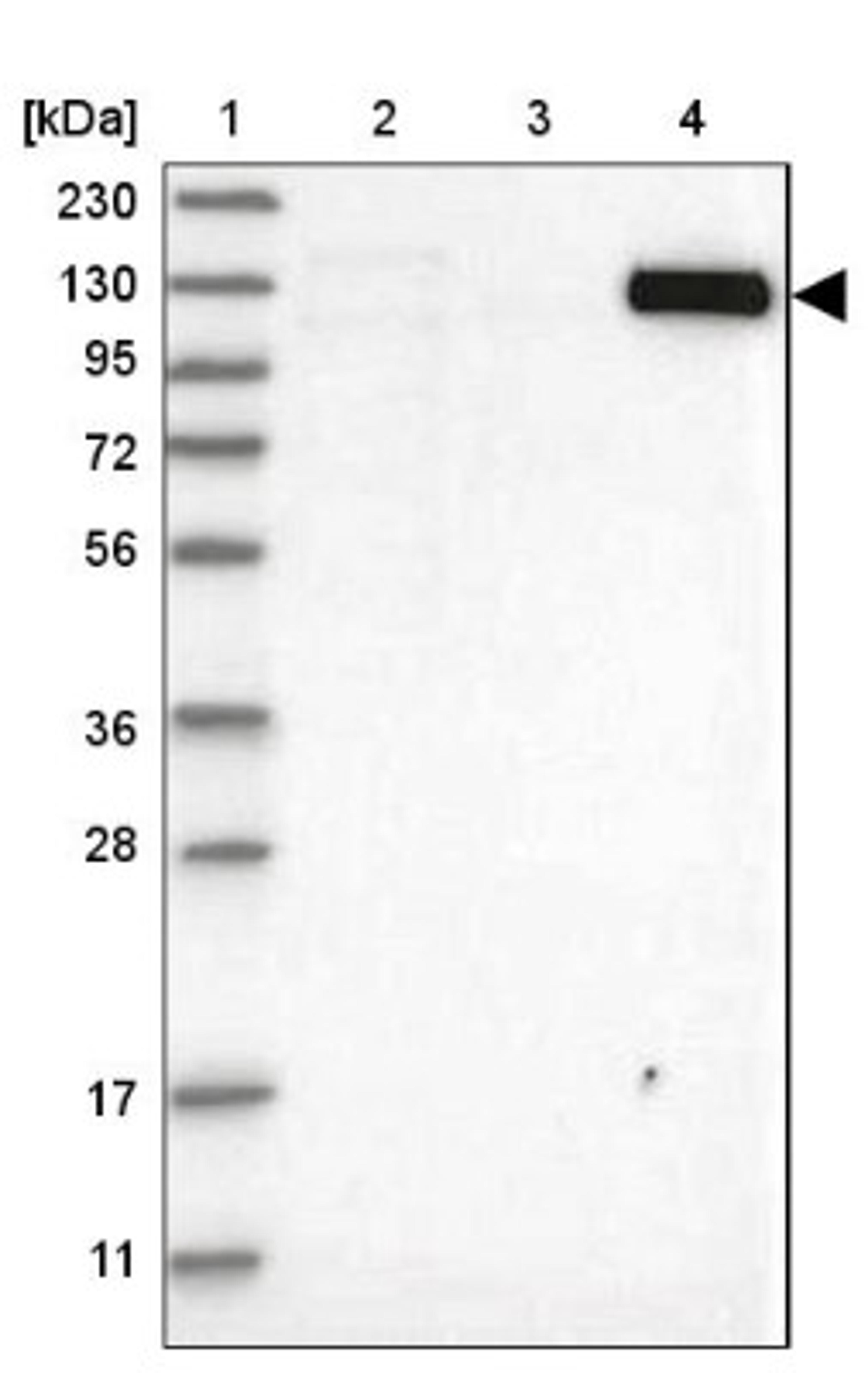 Western Blot: Mkl1 Antibody [NBP1-88498] - Lane 1: Marker [kDa] 230, 130, 95, 72, 56, 36, 28, 17, 11<br/>Lane 2: Human cell line RT-4<br/>Lane 3: Human cell line U-251MG sp<br/>Lane 4: Human plasma (IgG/HSA depleted)