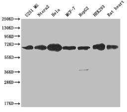 Western Blot. Positive WB detected in: U251 whole cell lysate, Ntera-2 whole cell lysate, Hela whole cell lysate, MCF-7 whole cell lysate, HepG2 whole cell lysate, HEK293 whole cell lysate, Rat heart tissue. All lanes: CBX2 antibody at 1:2000. Secondary. Goat polyclonal to rabbit IgG at 1/50000 dilution. Predicted band size: 57, 24 kDa. Observed band size: 60-72 kDa.