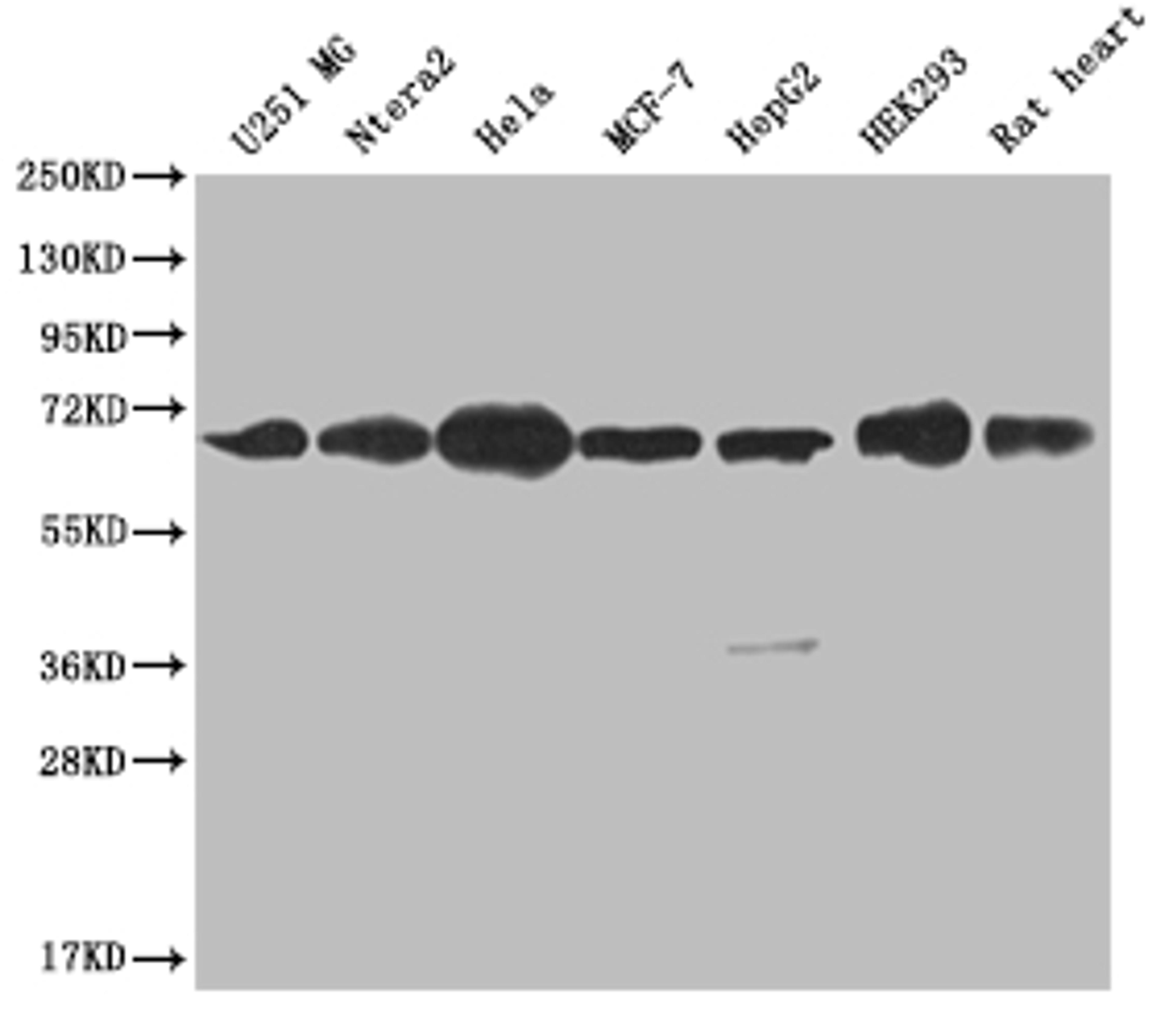 Western Blot. Positive WB detected in: U251 whole cell lysate, Ntera-2 whole cell lysate, Hela whole cell lysate, MCF-7 whole cell lysate, HepG2 whole cell lysate, HEK293 whole cell lysate, Rat heart tissue. All lanes: CBX2 antibody at 1:2000. Secondary. Goat polyclonal to rabbit IgG at 1/50000 dilution. Predicted band size: 57, 24 kDa. Observed band size: 60-72 kDa.