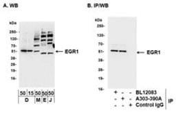 Detection of human and mouse EGR1 by western blot (h and m) and immunoprecipitation (m).