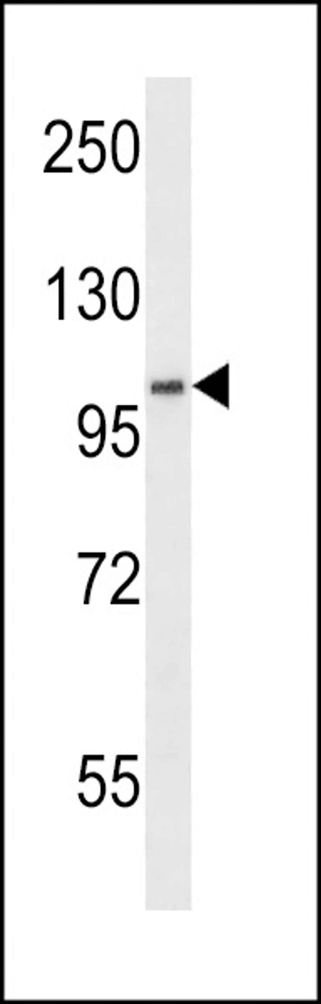 Western blot analysis in WiDr cell line lysates (35ug/lane).