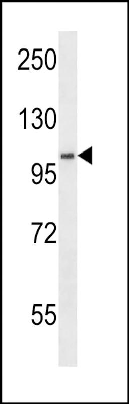 Western blot analysis in WiDr cell line lysates (35ug/lane).